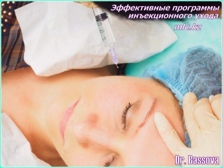 Инъекционная мезотерапия
