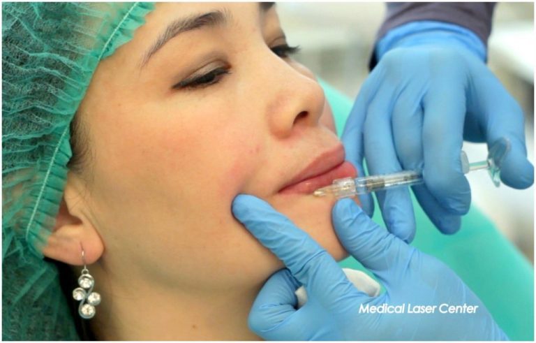 Контурная пластика