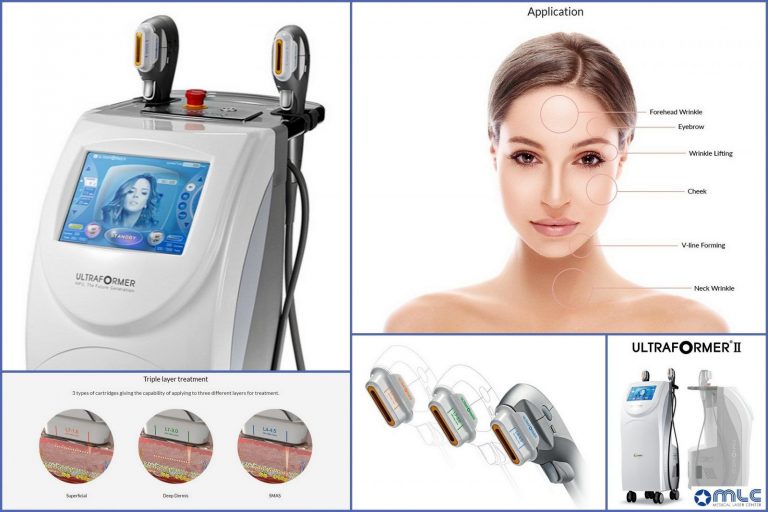 Коррекция овала лица без операции