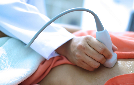 Кисты яичников