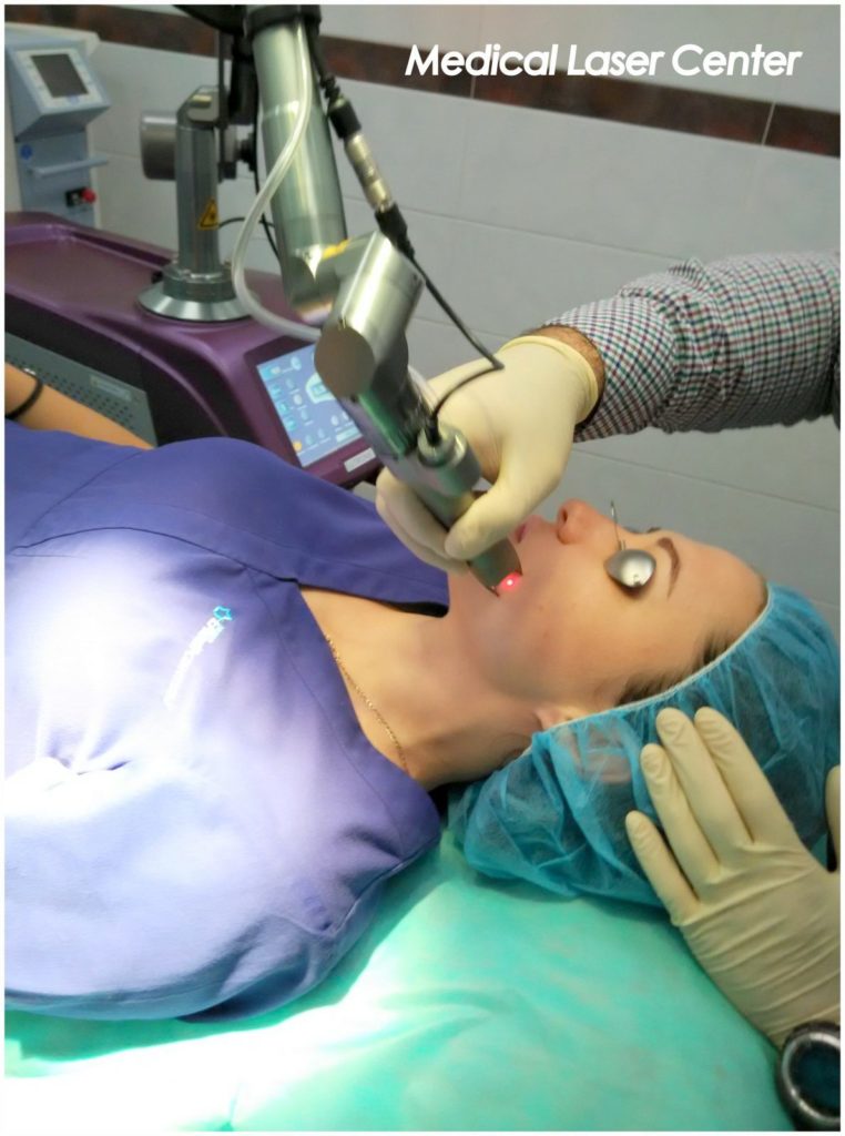 Лазерный пилинг кожи на аппарате Action 2: Lutronic, Shining peel