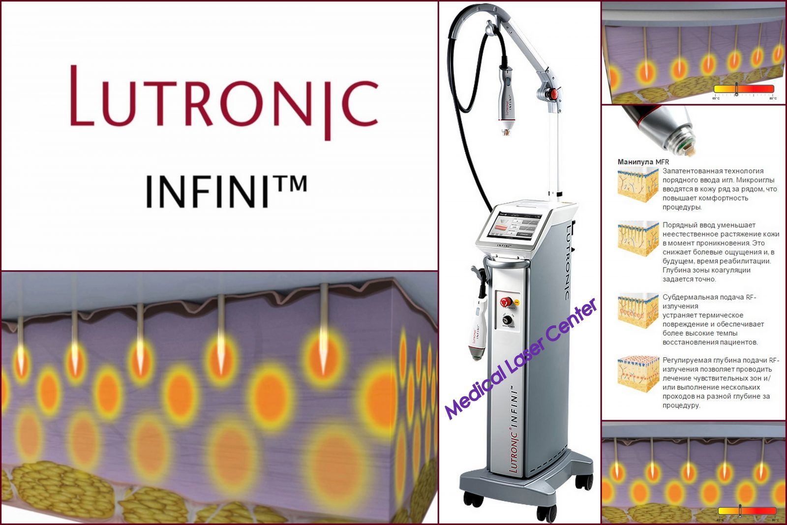 INFINI коллаж 1