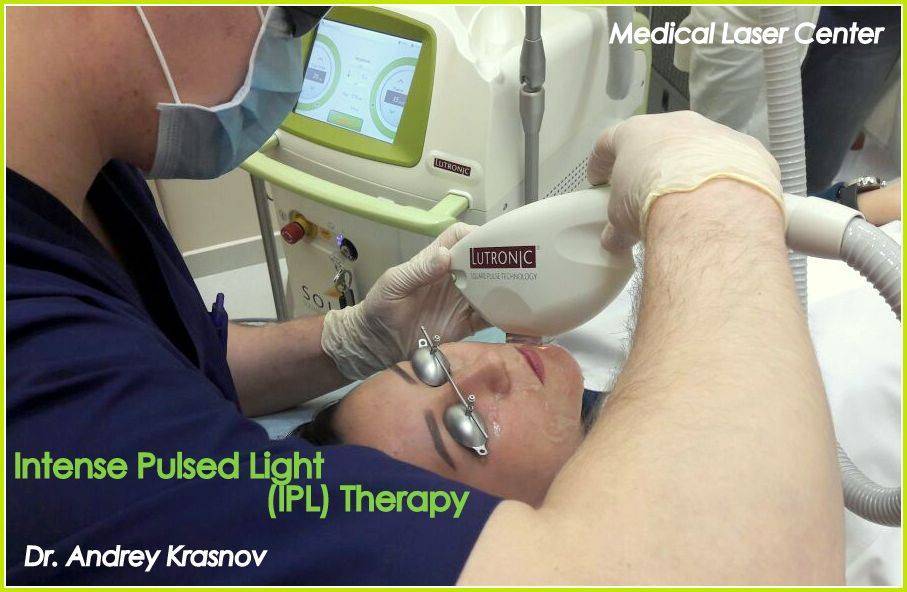 Тестирование аппарата IPL