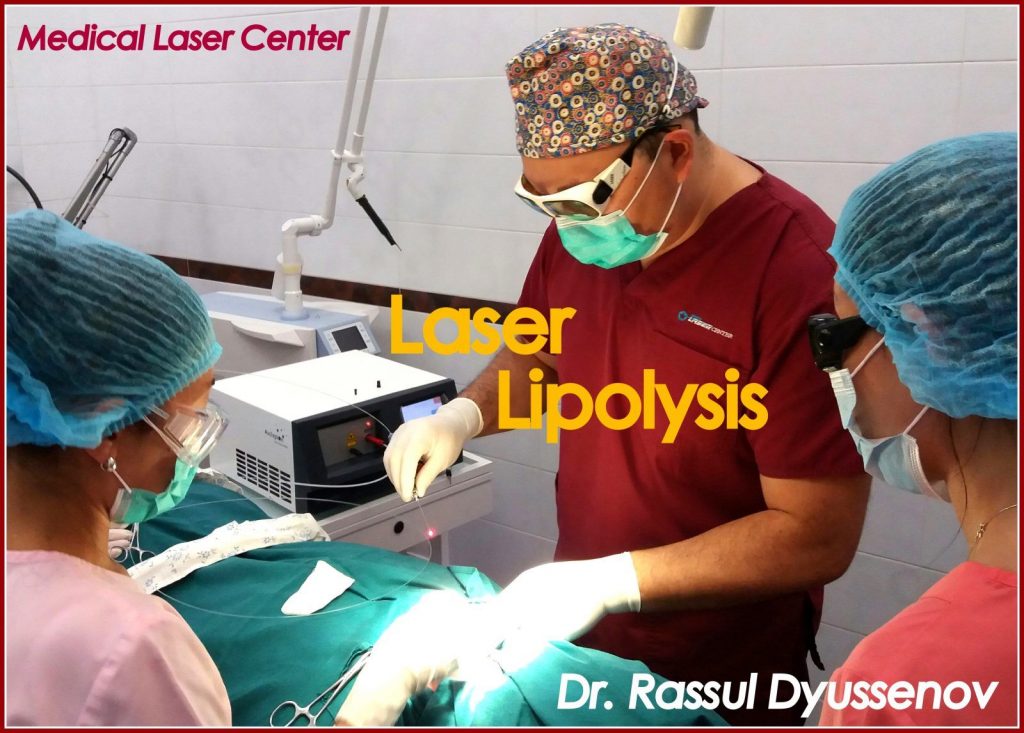 Лазерный липолиз