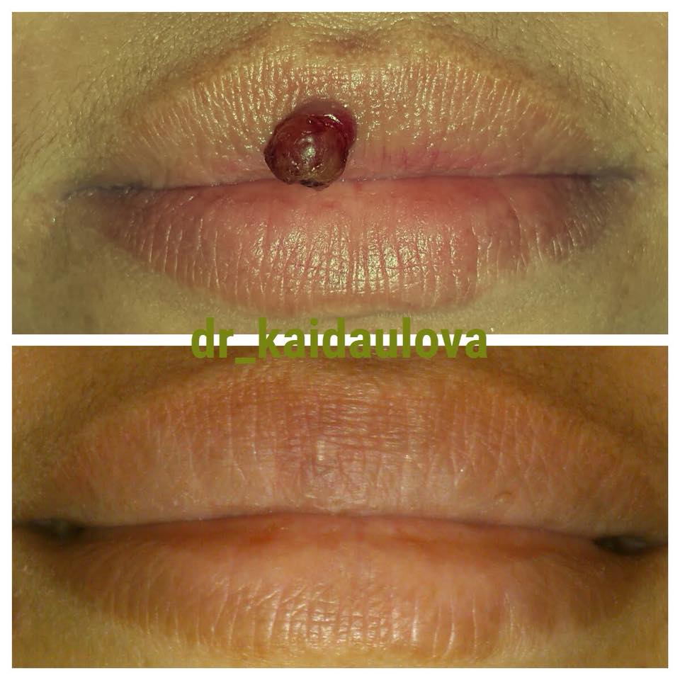 Лазер - волшебная палочка!