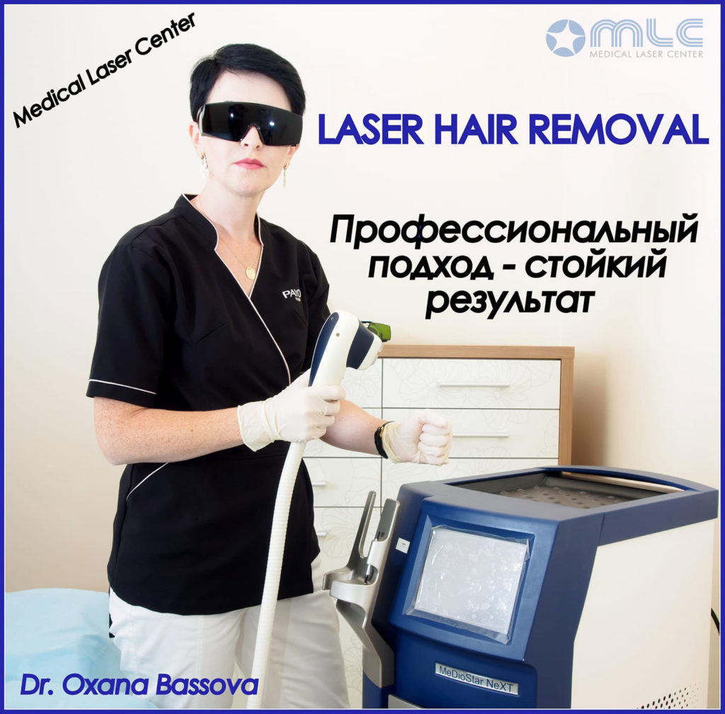 Лазерная эпиляция