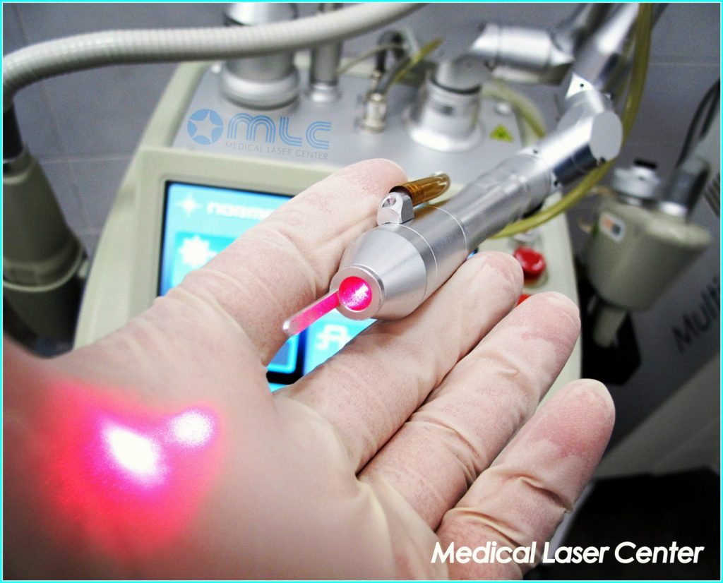 Как подтянуть веки без операции