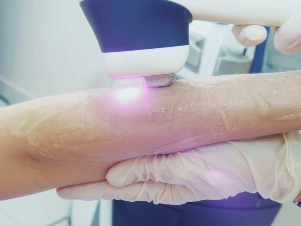 Лазерная эпиляция, медицинский лазерный центр, Алматы